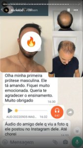 feedback