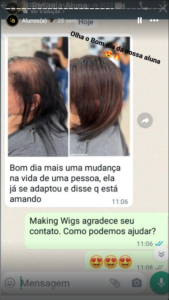 feedback